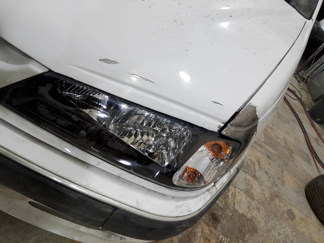 قبل و بعد صافکاری بیرنگی